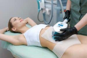 coolsculpting weight loss