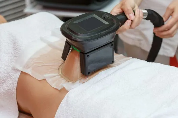 Image of person having fat freezing treatment to help weight gain Chorley
