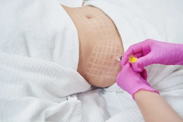 image of fat dissolving injections on love handles to help combat weight gain Chorley