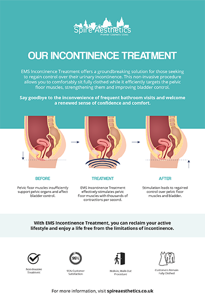 image of how urge incontinence Chorley treatment works