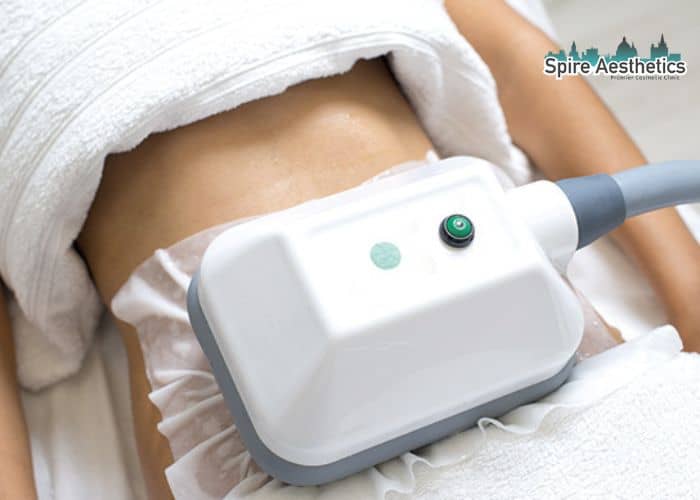 Shift Those Extra Pounds: How Fat Freezing Can Help You Slim Down Chorley
