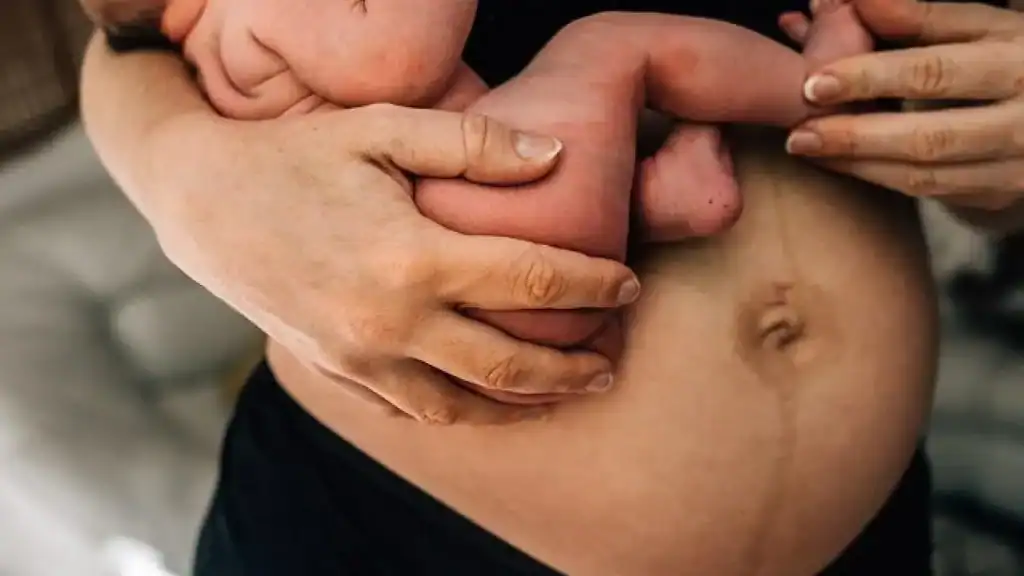 Why Is My Stomach Still Big After Pregnancy Chorley?